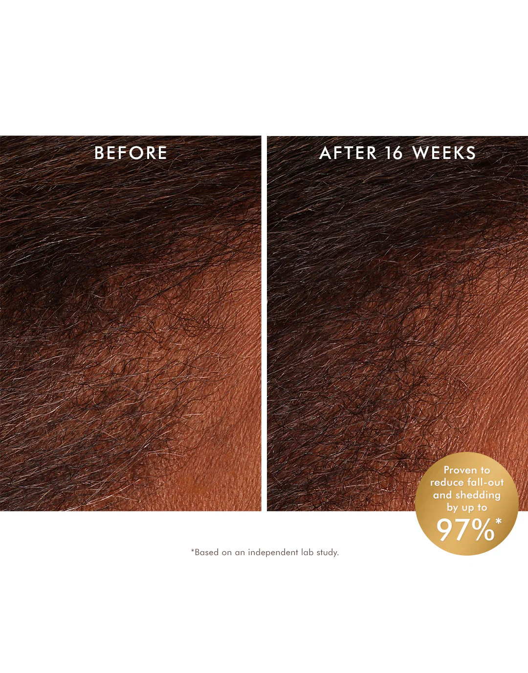 D3270A_Scalp_Lauch_Ppage_Assets_MO.Com_Crops_Tonic_-_Clinical_Claim.webp