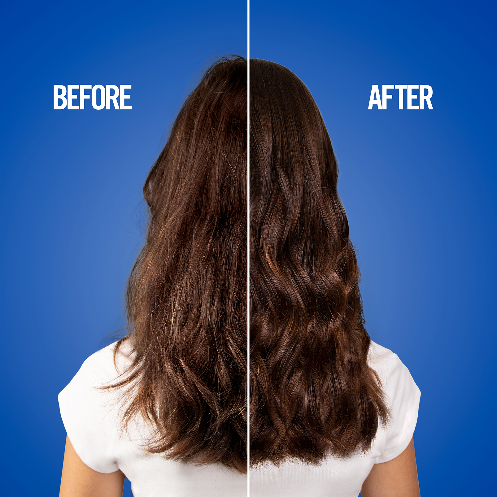 uniqone-new-treatment-2.webp